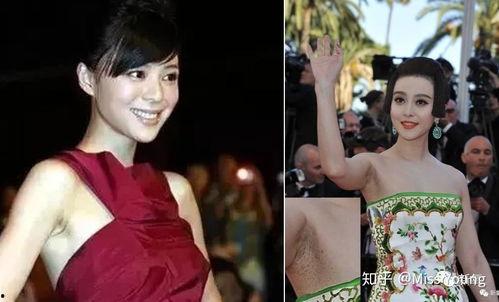 明星有脱毛,光滑肌肤的秘密武器